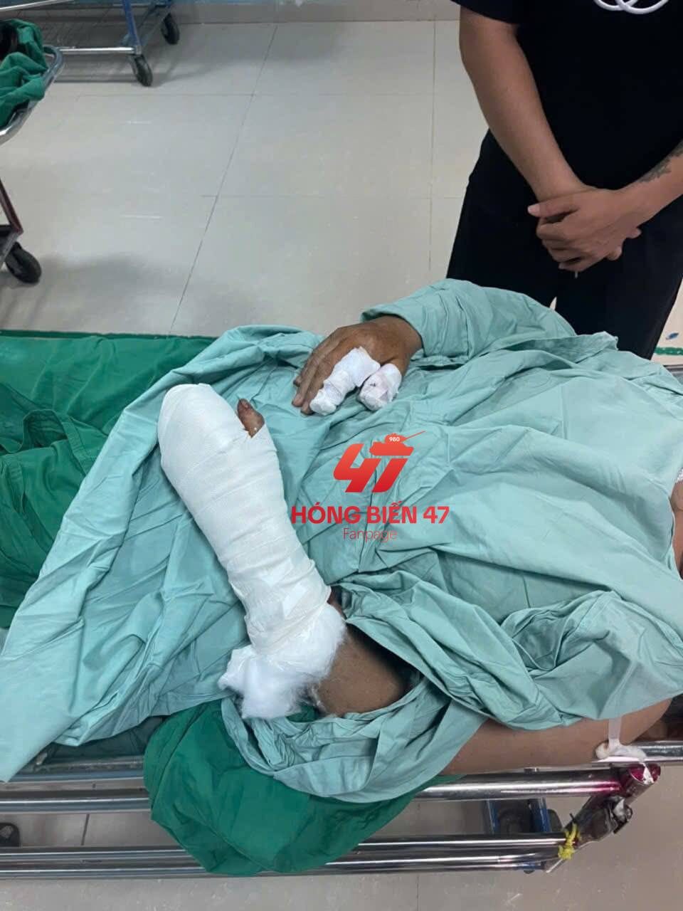 Chợ D ngay Ngã 3 Eakao, không rõ xích mích gì mà 2 cô quậy zậy