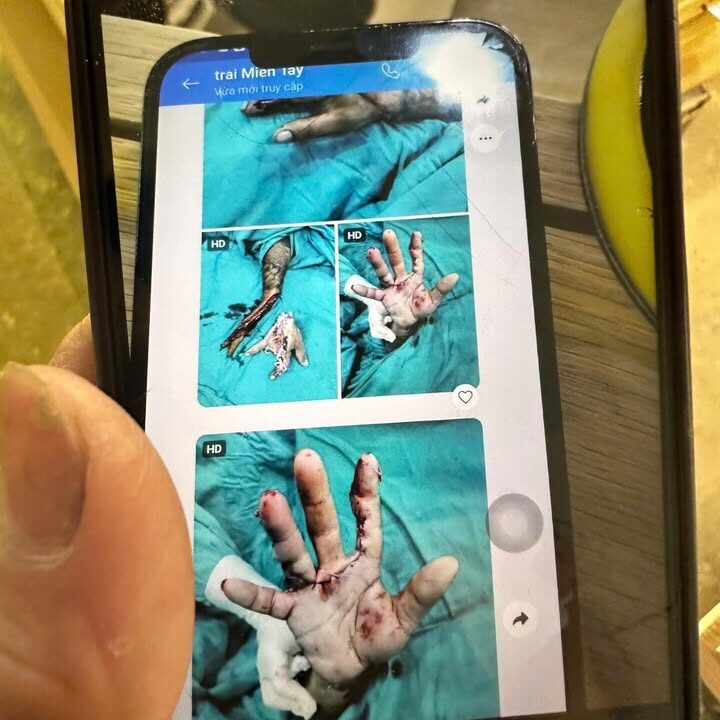 og:image