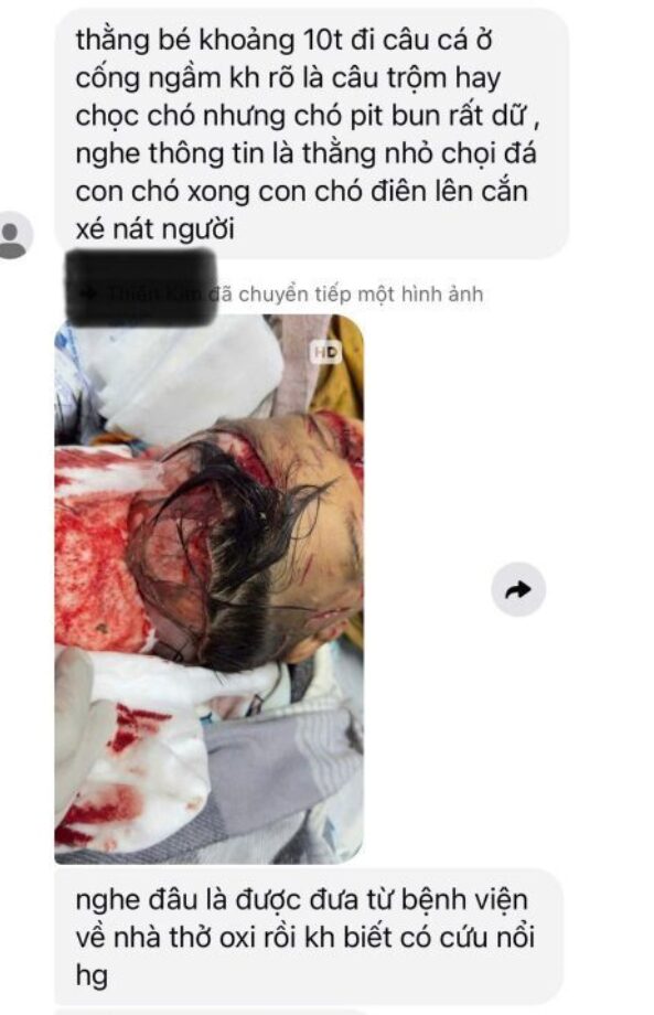 Tây Ninh: Trong lúc đi câu cá, một bé trai 11 tuổi đã bị đàn chó dữ tấn công, gây thương tích nặng phải nhập viện cấp cứu.