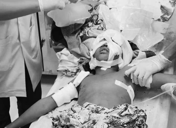 Tây Ninh: Trong lúc đi câu cá, một bé trai 11 tuổi đã bị đàn chó dữ tấn công, gây thương tích nặng phải nhập viện cấp cứu.